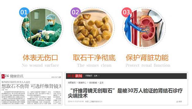 患者疑问：肾结石怎么治疗好？(图9)