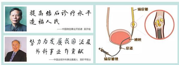 肾结石的治疗方法大全都在这里！(图13)