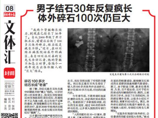 男子结石30年反复疯长 体外碎石100次仍巨大(图4)
