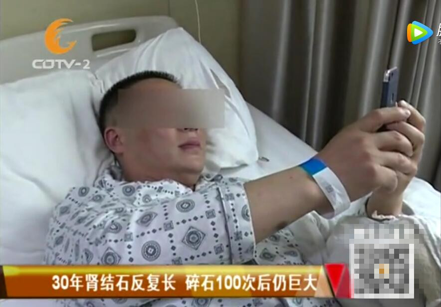 三十年 百余次体外碎石 男子结石反而长满肾脏(图1)