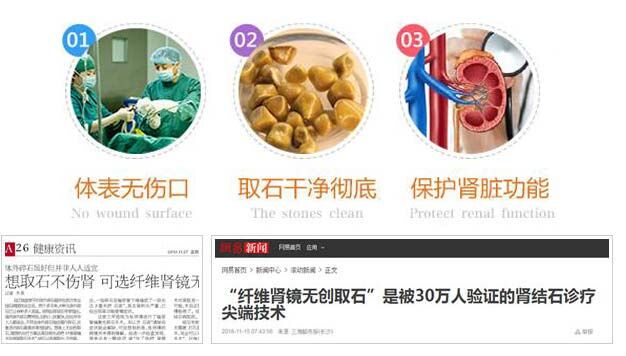肾结石手术要多少钱？(已解决6955条)(图3)