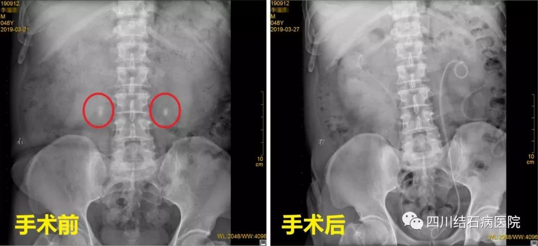 震惊！邛崃男子的“排尿通道”竟然全堵了....(图1)