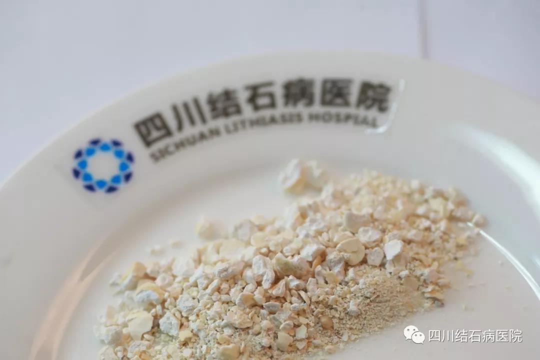 震惊！邛崃男子的“排尿通道”竟然全堵了....(图4)