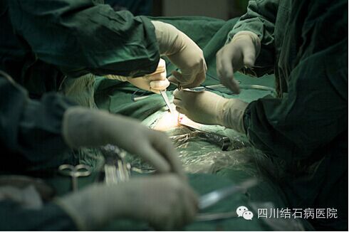腹痛只当胃不好  胆囊积水让患者命悬一线(图2)