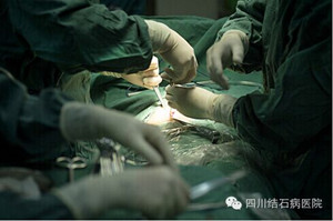 胆结石的手术方法是什么？(图1)