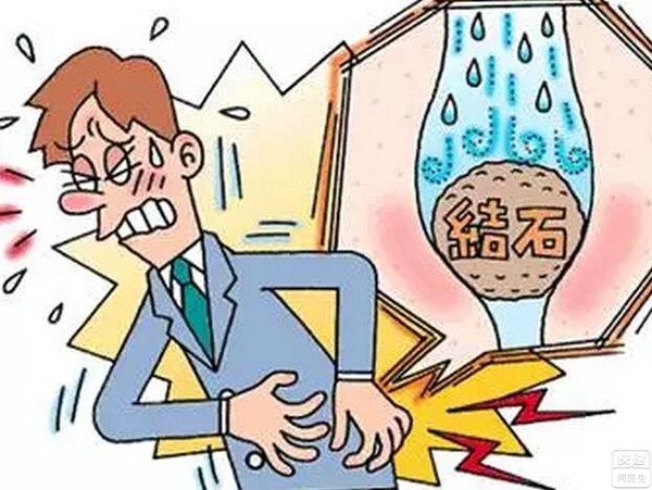 成都体外碎石价格(图1)