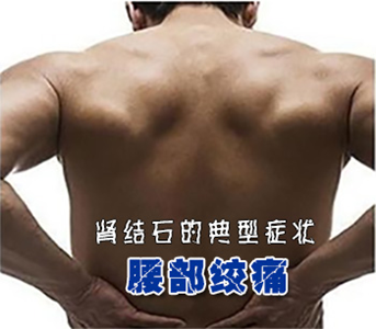 肾结石得症状有哪些(图1)