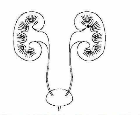 尿结石的症状及危害你了解多少？(图1)