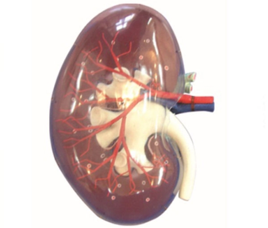 熬出来的结石 憋出来的炎症(图5)