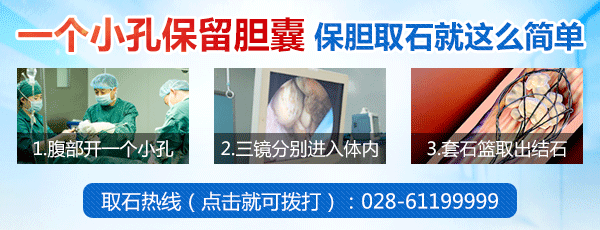 清楚了解什么是胆囊结石？(图3)