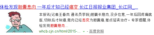关于胆囊息肉的那点事！(图4)