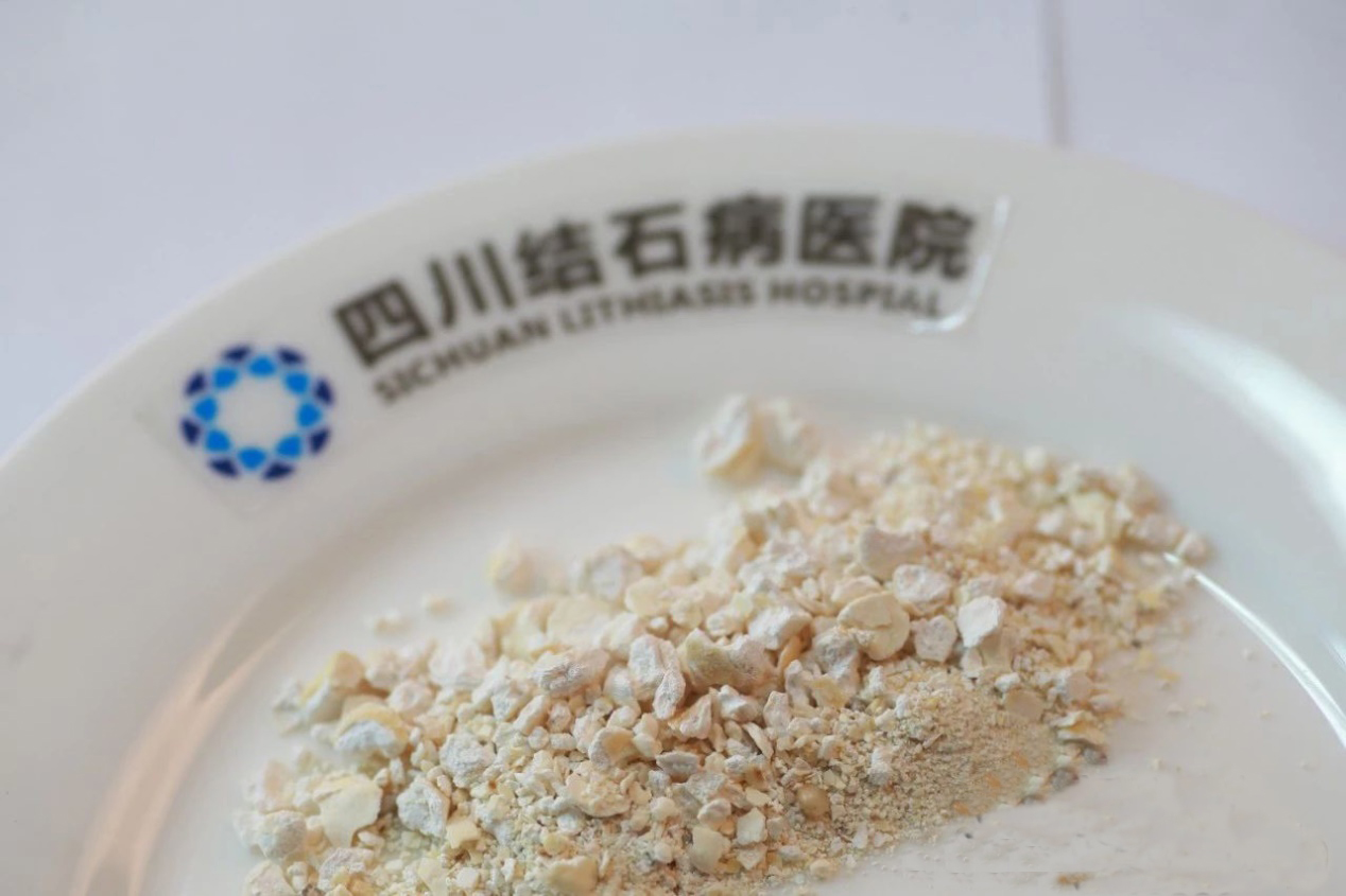 体外碎石？吃药排石？小心4年后，像他一样“排尿通道”全堵(图4)
